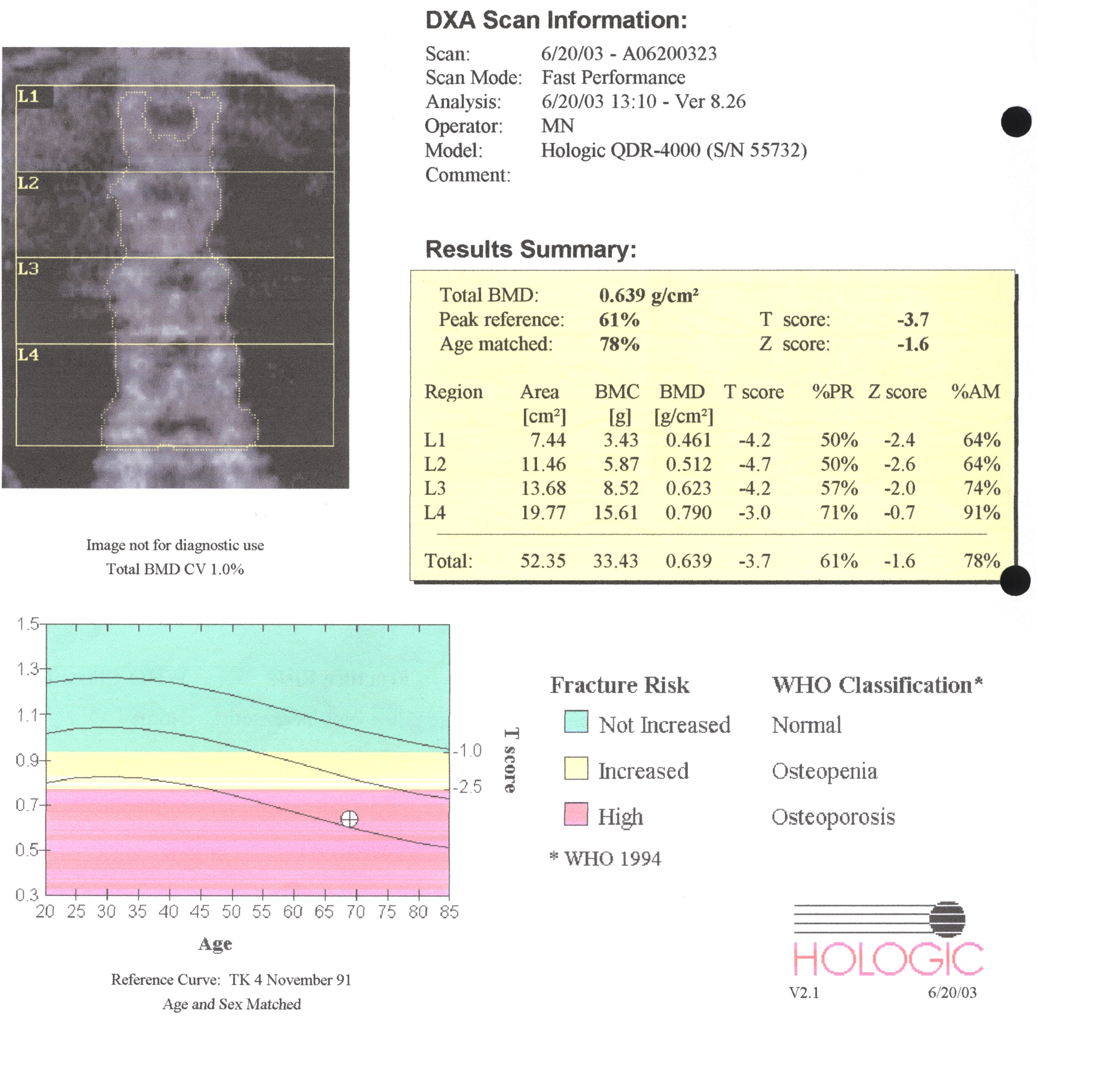 DXA-Ergebnis, Copyright Dr. W. Zimmermann