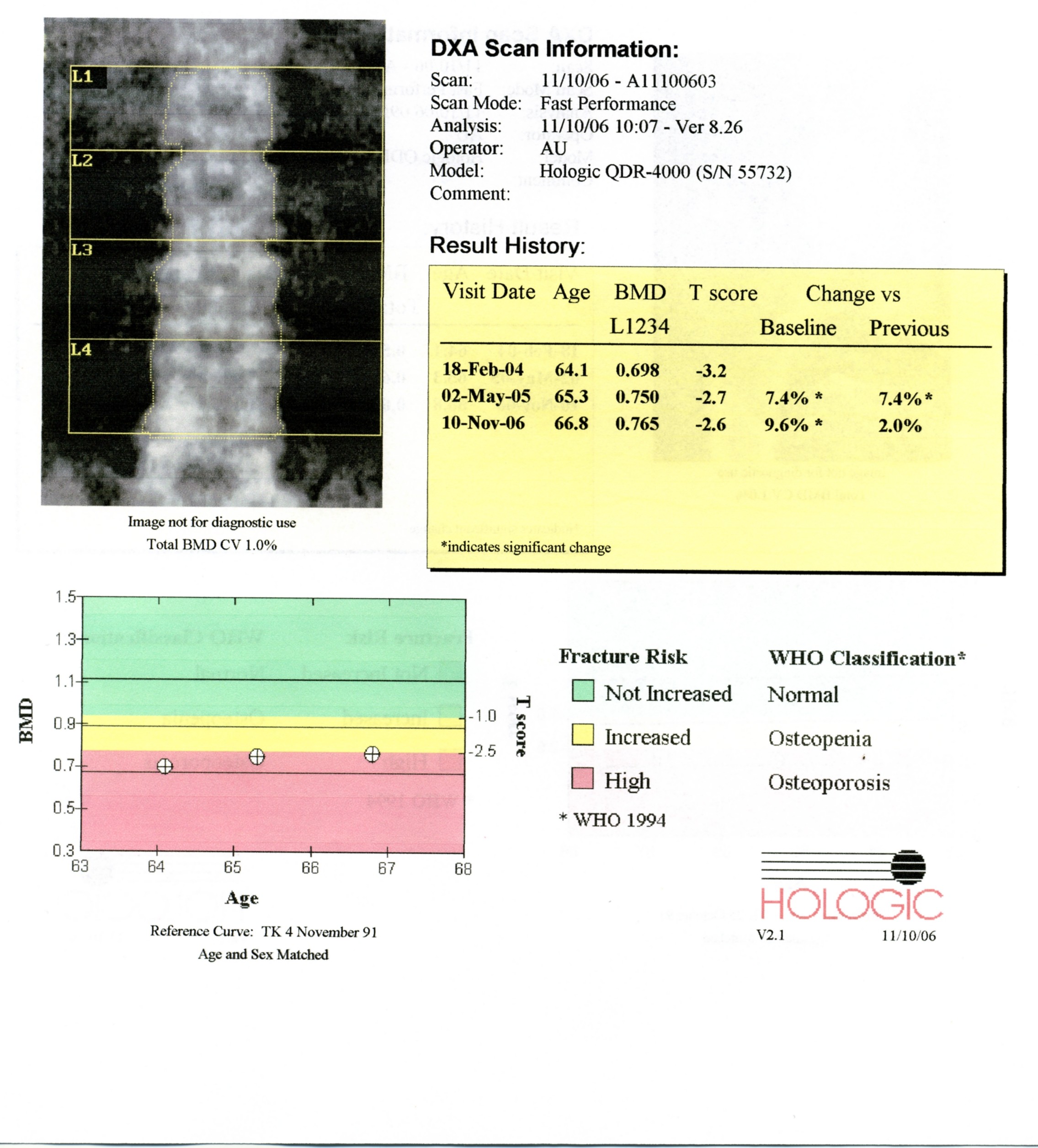DXA-Verlaufsmessung, Copyright Dr. W. Zimmermann